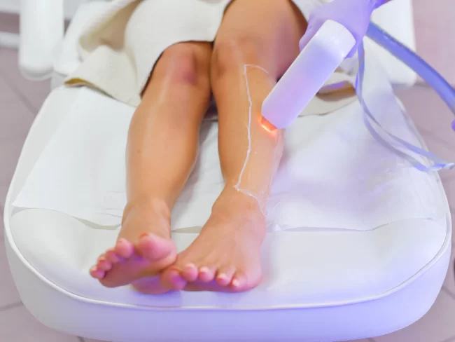 Laser Hair Removal Labia